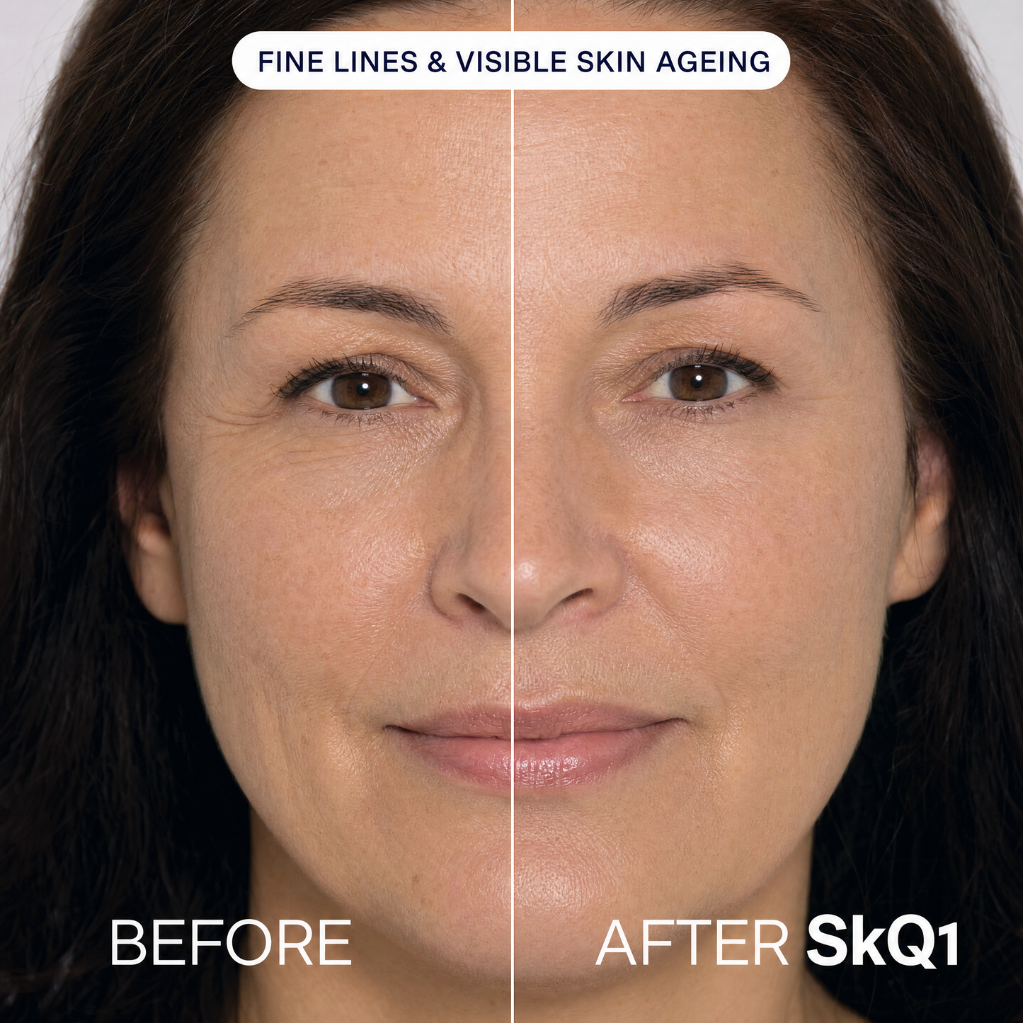 SKQ1 Serum