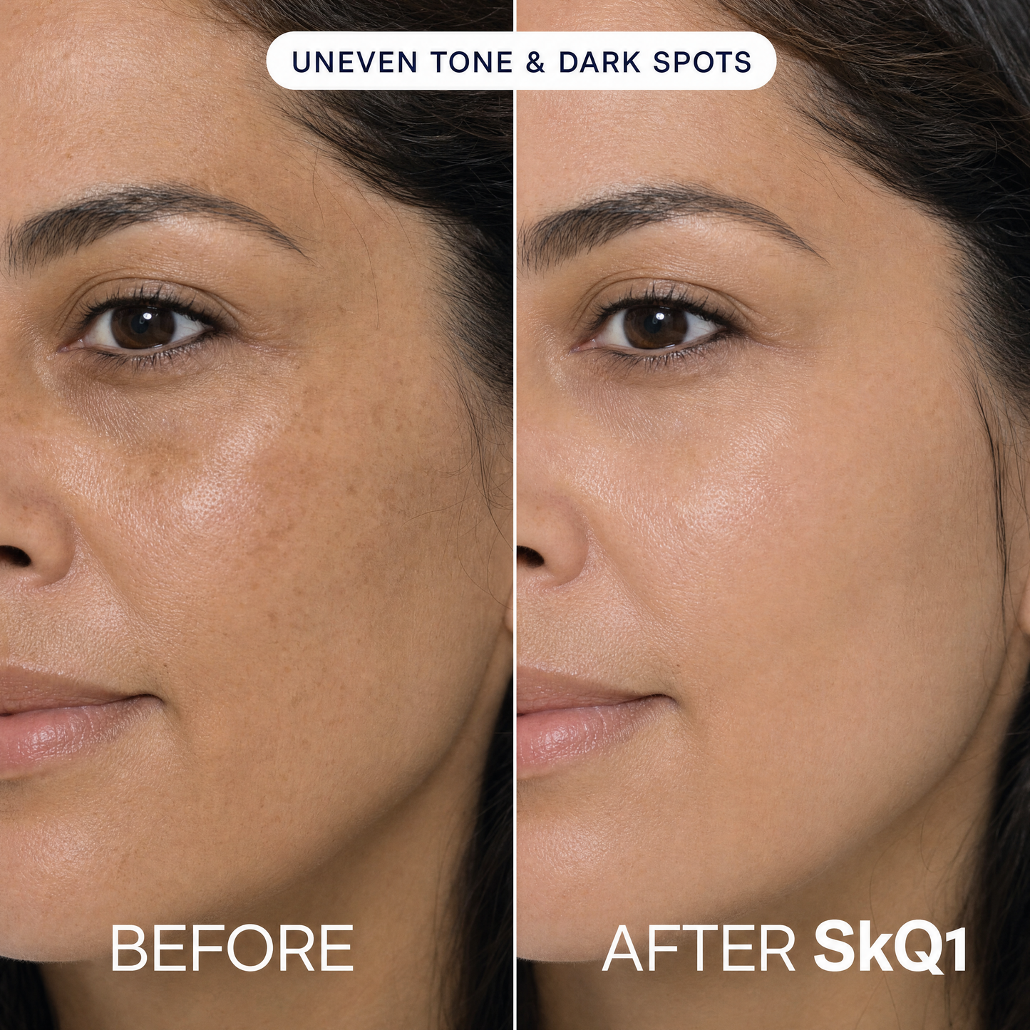 SKQ1 Serum